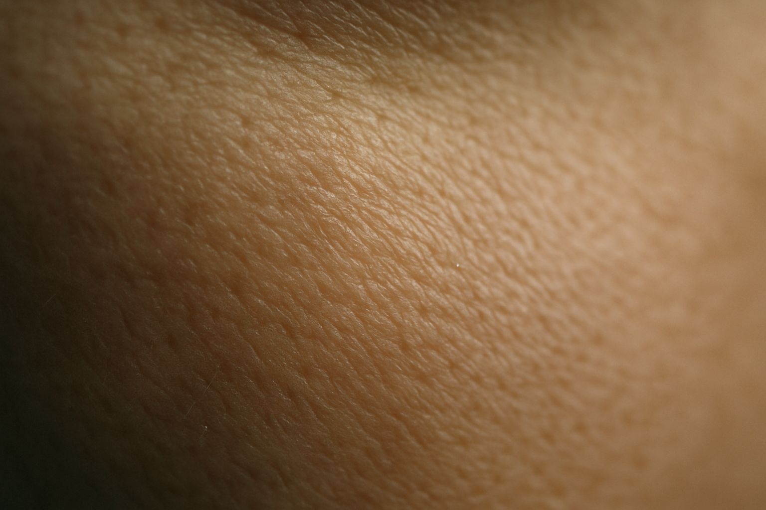 Chemical Peels in Glasgow